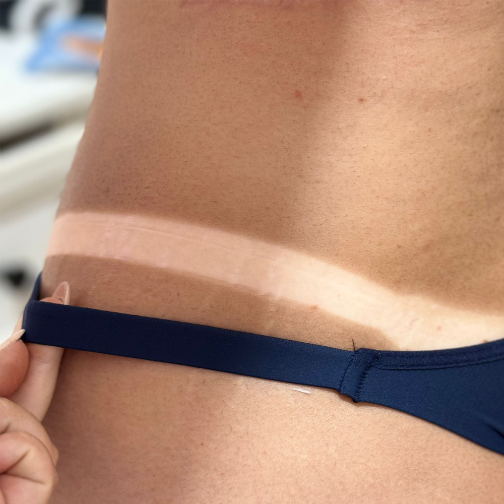 fita-bronzeamento-kit-5-rolos-com-10-medidas-20m-cinza-67fd54f8e0783-large